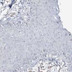 PEAR1 Antibody in Immunohistochemistry (Paraffin) (IHC (P))