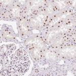 HNF1A Antibody in Immunohistochemistry (Paraffin) (IHC (P))