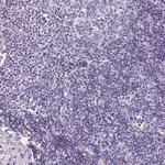 HNF1A Antibody in Immunohistochemistry (Paraffin) (IHC (P))