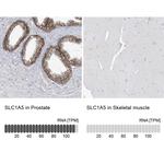 ASCT2 Antibody