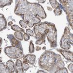 ASCT2 Antibody in Immunohistochemistry (Paraffin) (IHC (P))