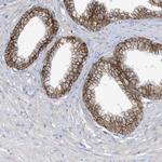 ASCT2 Antibody in Immunohistochemistry (Paraffin) (IHC (P))