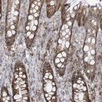 ASCT2 Antibody in Immunohistochemistry (Paraffin) (IHC (P))