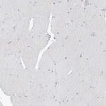 ASCT2 Antibody in Immunohistochemistry (Paraffin) (IHC (P))