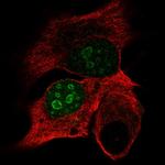 DPPA4 Antibody in Immunocytochemistry (ICC/IF)