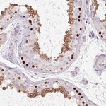 DPPA4 Antibody in Immunohistochemistry (Paraffin) (IHC (P))