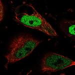 Cdc7 Antibody in Immunocytochemistry (ICC/IF)