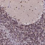 Cdc7 Antibody in Immunohistochemistry (Paraffin) (IHC (P))