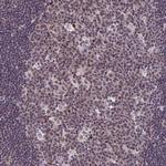 Cdc7 Antibody in Immunohistochemistry (Paraffin) (IHC (P))