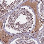 Cdc7 Antibody in Immunohistochemistry (Paraffin) (IHC (P))