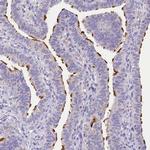 CGI58 Antibody in Immunohistochemistry (Paraffin) (IHC (P))