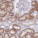 CGI58 Antibody in Immunohistochemistry (Paraffin) (IHC (P))