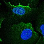 alpha Adducin Antibody in Immunocytochemistry (ICC/IF)