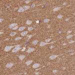 alpha Adducin Antibody in Immunohistochemistry (Paraffin) (IHC (P))