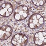 alpha Adducin Antibody in Immunohistochemistry (Paraffin) (IHC (P))