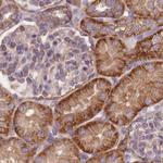 alpha Adducin Antibody in Immunohistochemistry (Paraffin) (IHC (P))