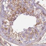 alpha Adducin Antibody in Immunohistochemistry (Paraffin) (IHC (P))