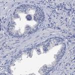 beta Synuclein Antibody in Immunohistochemistry (Paraffin) (IHC (P))