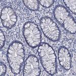 beta Synuclein Antibody in Immunohistochemistry (Paraffin) (IHC (P))