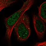 SLU7 Antibody in Immunocytochemistry (ICC/IF)