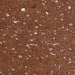 Ankyrin B Antibody in Immunohistochemistry (Paraffin) (IHC (P))