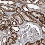 PIK3R4 Antibody in Immunohistochemistry (Paraffin) (IHC (P))