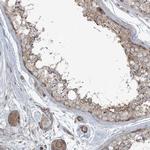 PIK3R4 Antibody in Immunohistochemistry (Paraffin) (IHC (P))