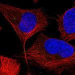 PPAT Antibody in Immunocytochemistry (ICC/IF)