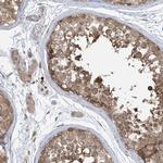 PPAT Antibody in Immunohistochemistry (Paraffin) (IHC (P))