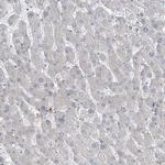 PPAT Antibody in Immunohistochemistry (Paraffin) (IHC (P))