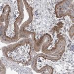 PPAT Antibody in Immunohistochemistry (Paraffin) (IHC (P))