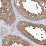 PPAT Antibody in Immunohistochemistry (Paraffin) (IHC (P))