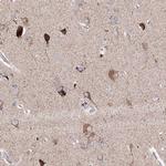 Glutaminase Antibody in Immunohistochemistry (Paraffin) (IHC (P))