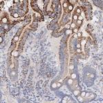 Glutaminase Antibody in Immunohistochemistry (Paraffin) (IHC (P))