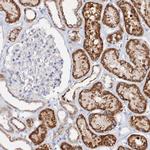 Glutaminase Antibody in Immunohistochemistry (Paraffin) (IHC (P))