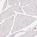 Glutaminase Antibody in Immunohistochemistry (Paraffin) (IHC (P))