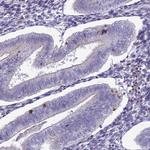 CD103 Antibody in Immunohistochemistry (Paraffin) (IHC (P))