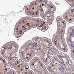 CD103 Antibody in Immunohistochemistry (Paraffin) (IHC (P))