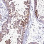 CD103 Antibody in Immunohistochemistry (Paraffin) (IHC (P))