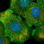 CD104 Antibody in Immunocytochemistry (ICC/IF)