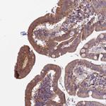 CD104 Antibody in Immunohistochemistry (Paraffin) (IHC (P))