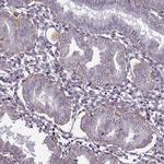 CD104 Antibody in Immunohistochemistry (Paraffin) (IHC (P))