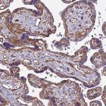 CD104 Antibody in Immunohistochemistry (Paraffin) (IHC (P))