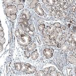 CD104 Antibody in Immunohistochemistry (Paraffin) (IHC (P))