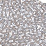 CD104 Antibody in Immunohistochemistry (Paraffin) (IHC (P))