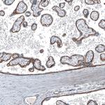 CD104 Antibody in Immunohistochemistry (Paraffin) (IHC (P))