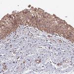 CD104 Antibody in Immunohistochemistry (Paraffin) (IHC (P))