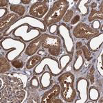 GCLC Antibody in Immunohistochemistry (Paraffin) (IHC (P))