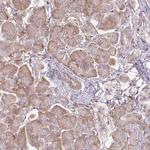 RASA1 Antibody in Immunohistochemistry (Paraffin) (IHC (P))