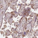 RASA1 Antibody in Immunohistochemistry (Paraffin) (IHC (P))